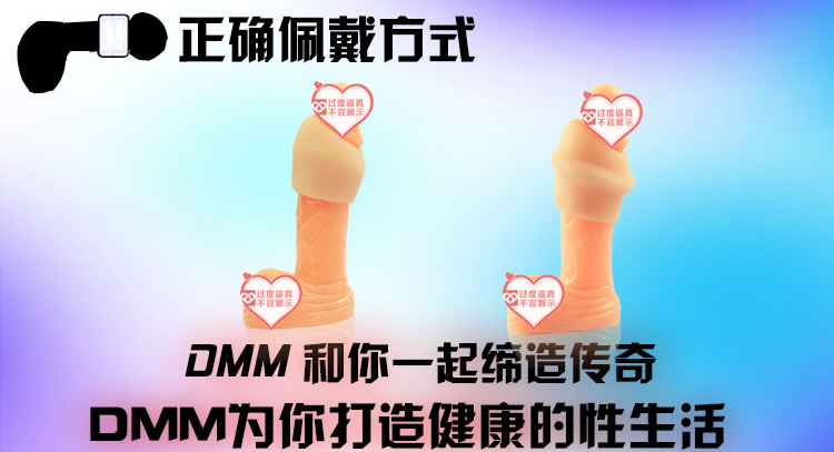 DMM包皮包茎阻复环